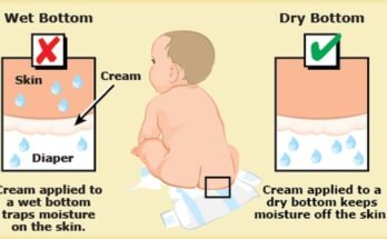 Baby Rash Treatment