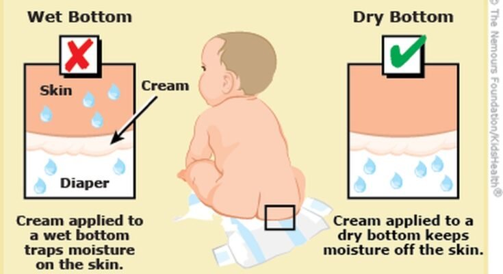 Baby Rash Treatment
