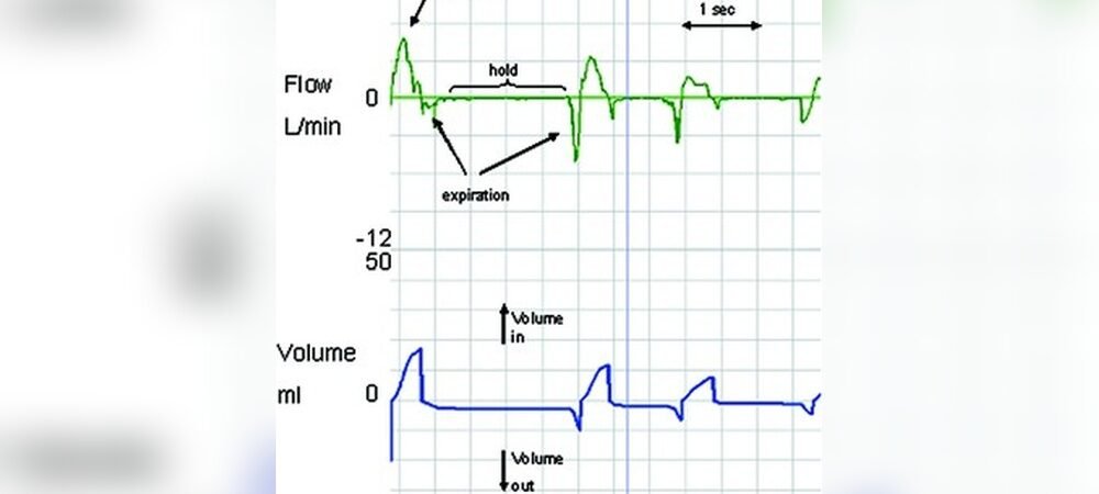 Breathing Patterns in Newborn