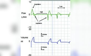 Breathing Patterns in Newborn
