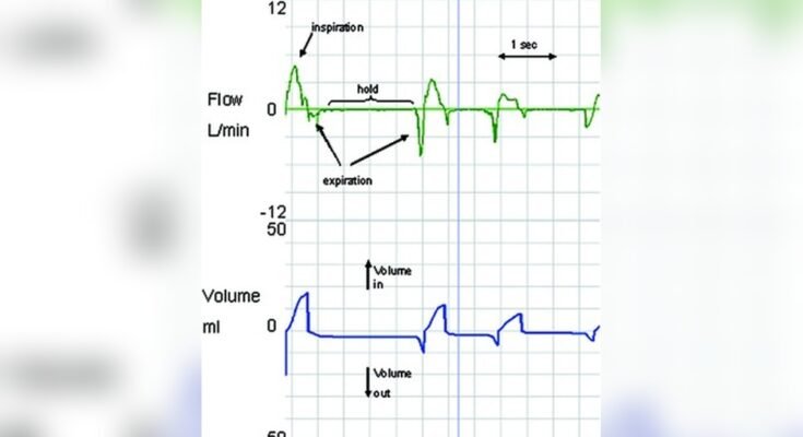 Breathing Patterns in Newborn