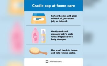 Cradle Cap Management