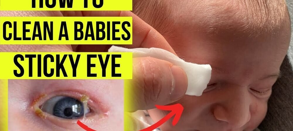 Eye Discharge in Newborn