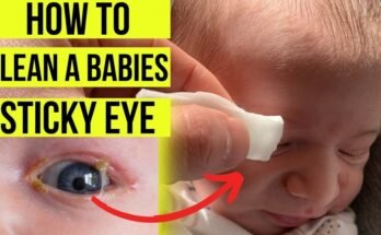 Eye Discharge in Newborn