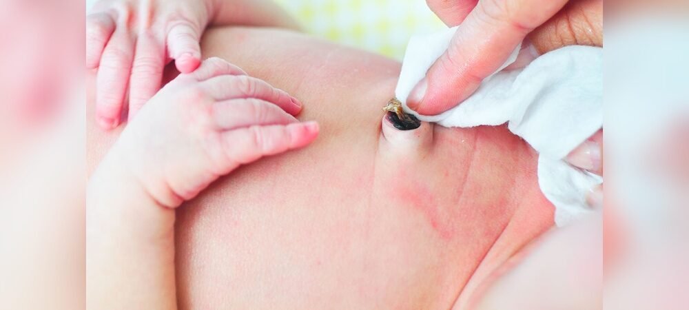 How to Care for Baby’S Umbilical Cord
