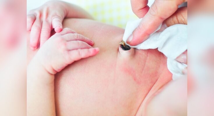 How to Care for Baby’S Umbilical Cord