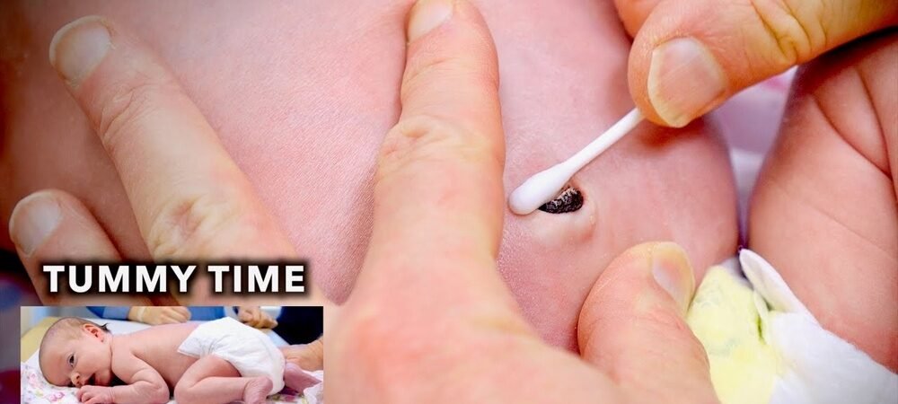 How to Clean Newborn Belly Button