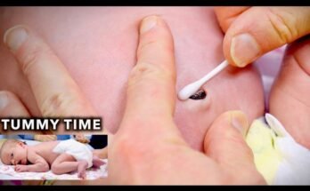 How to Clean Newborn Belly Button