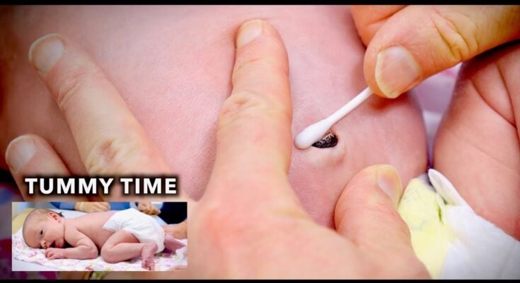 How to Clean Newborn Belly Button