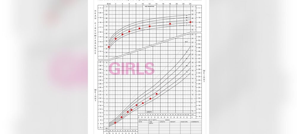 How to Recognize Abnormal Growth Patterns in Newborn