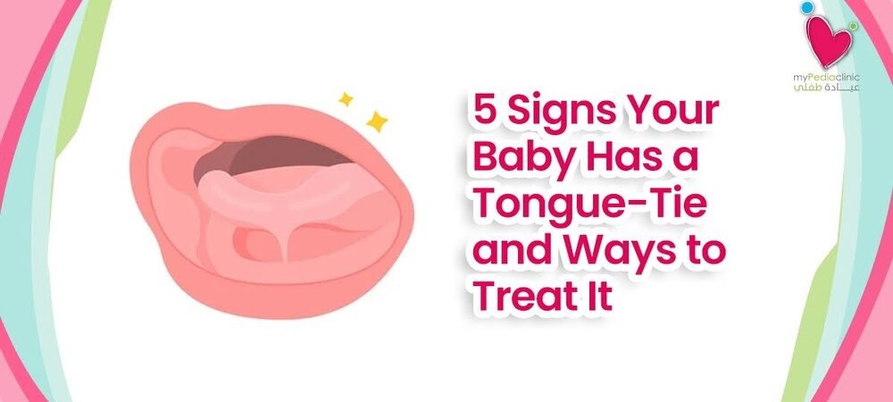 How to Recognize Signs of Frustration in Newborn