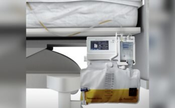 Monitoring Urine Output