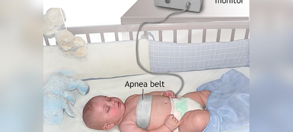 Newborn Apnea Monitoring