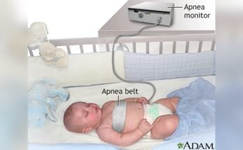 Newborn Apnea Monitoring