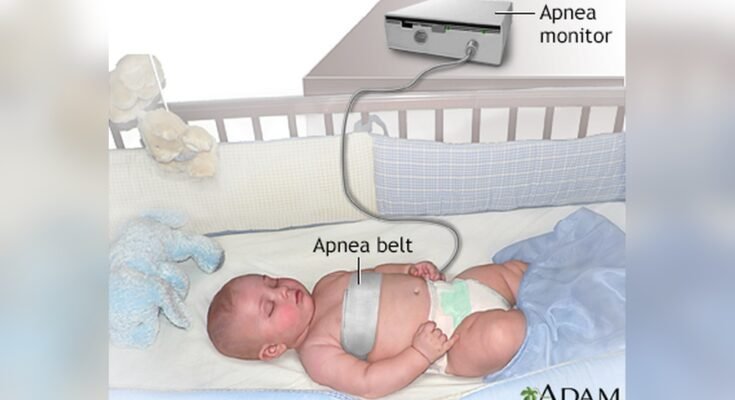 Newborn Apnea Monitoring