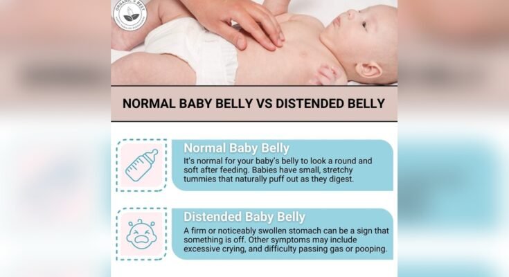 Newborn Bloating