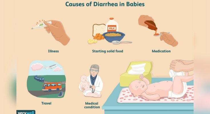 Newborn Diarrhea Causes