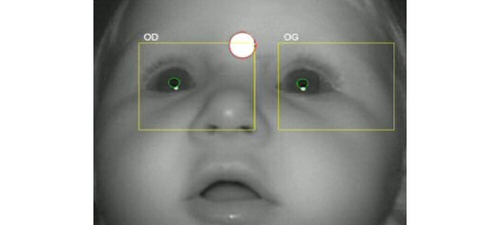 Newborn Vision Checks