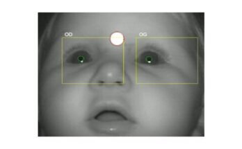 Newborn Vision Checks