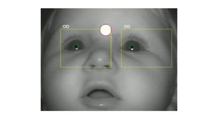 Newborn Vision Checks