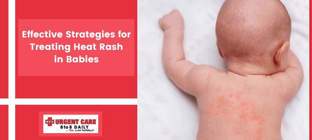Preventing Heat Rash in Babies