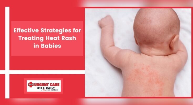 Preventing Heat Rash in Babies